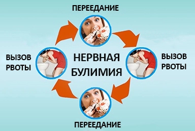 Лечение булимии в Комаровском